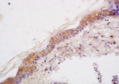 LCE2B Rabbit Polyclonal Antibody