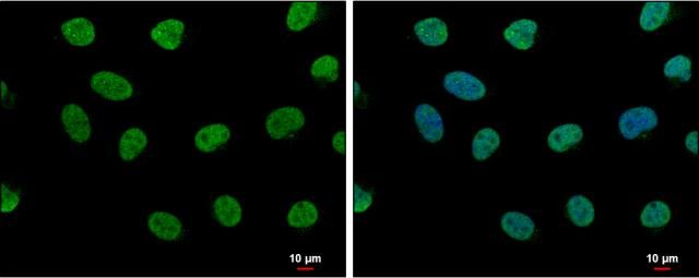 LIM domain binding 1 Antibody