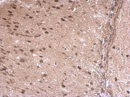 LIM domain binding 1 Antibody