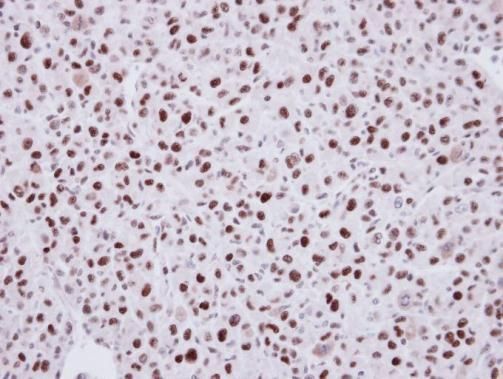 LIM domain binding 1 Antibody