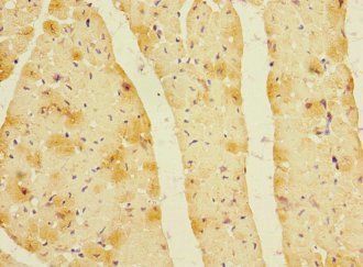 LDB3 Antibody