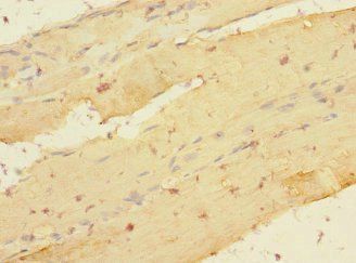 LDB3 Antibody