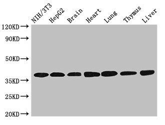 LDHC Antibody