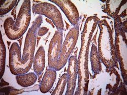 LDHC (aa 217 - 231) Antibody