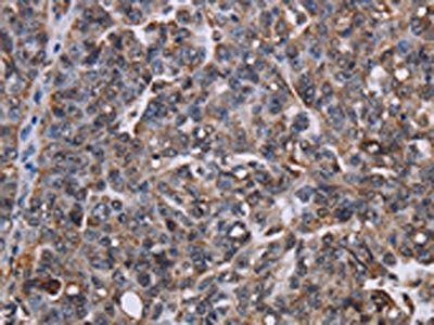 LDOC1 Antibody