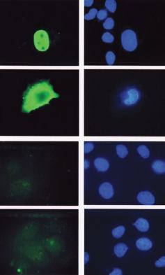 Mouse anti Human LEF-1 beta catenin Antibody