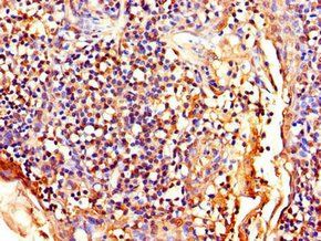 LEF1 Antibody