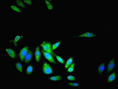 LRRFIP1 Antibody