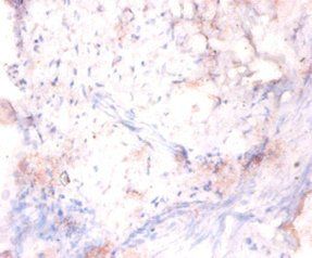 LRRFIP1 Antibody