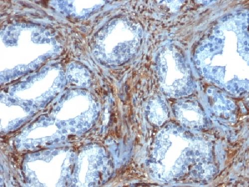 LGALS1 Antibody