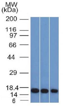 LGALS1 Antibody
