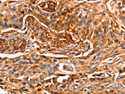 LGALS1 Antibody