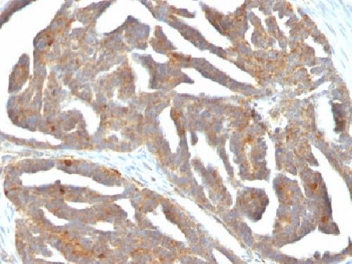 GNRHR Antibody