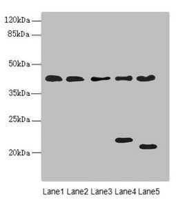 LHX6 Antibody