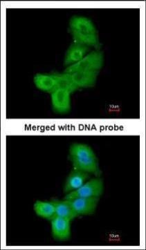 LIM kinase 2 Rabbit Polyclonal Antibody