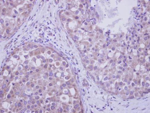 LIM kinase 2 Rabbit Polyclonal Antibody