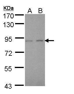 LIM kinase 2 Rabbit Polyclonal Antibody