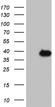 LIM kinase 2 Antibody