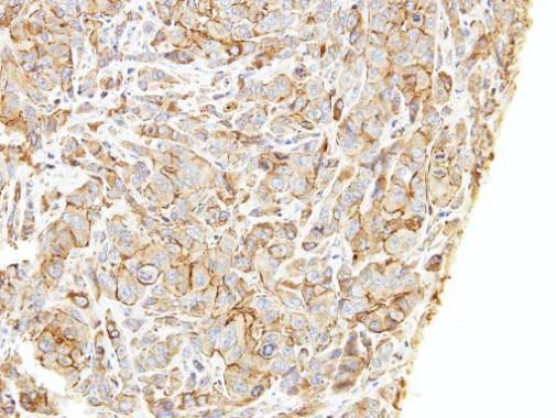 LIMCH1 Rabbit Polyclonal Antibody
