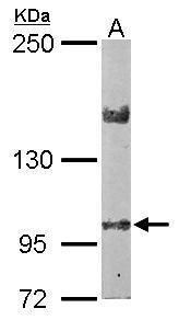 LIMCH1 Rabbit Polyclonal Antibody