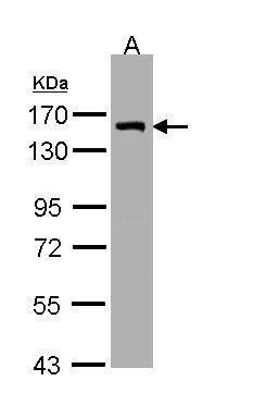 LIMCH1 Rabbit Polyclonal Antibody