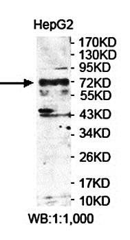 LIMD1 Rabbit Polyclonal Antibody