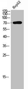 LIMK1/LIMK2 Antibody