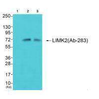 LIMK2 Antibody