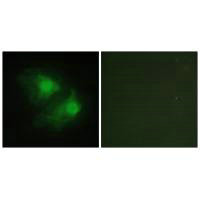 LIMK2 Antibody