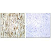 LIMK2 Antibody