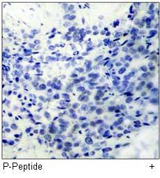 LIMK2 (Phospho-Thr505) Antibody