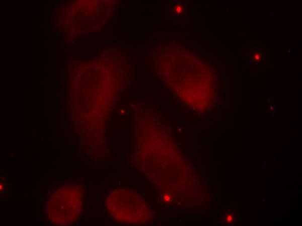 LIMK2 (Phospho-Thr505) Antibody