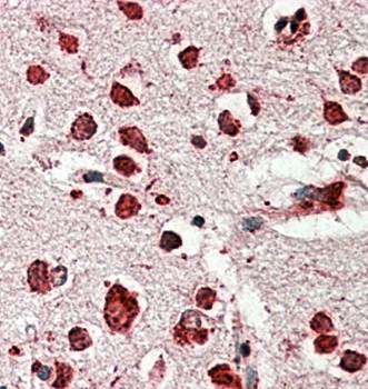 LIMP2/SCARB2 Antibody