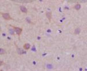 Phospho-LLGL1 + LLGL2 (Ser650+Ser654) Rabbit Polyclonal Antibody