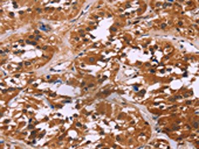 LMNB1 Antibody