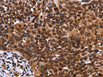 LMNB1 Antibody