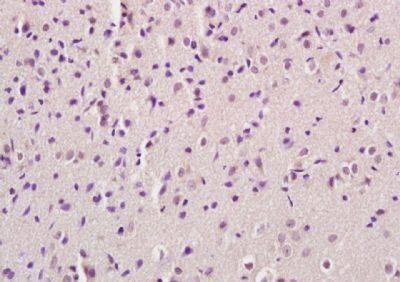 LMO2 Rabbit Polyclonal Antibody