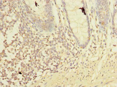 LMO3 Antibody