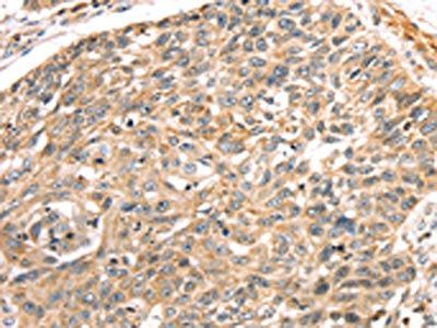 LONP1 Antibody
