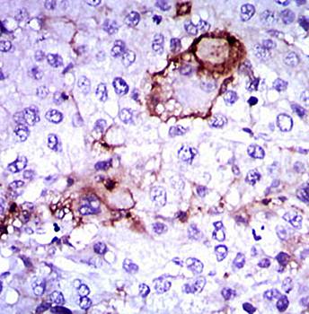 LPA Antibody