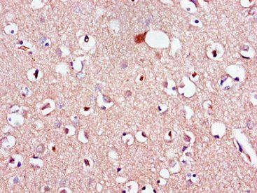LPAR1 Antibody