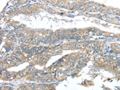 LPAR1 Antibody