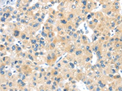 LPAR1 Antibody