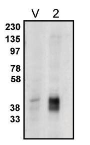 Rabbit Human Lysophospholipid Phosphatase (LPP) 2 Antibody