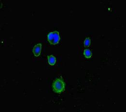 LRCH1 Antibody