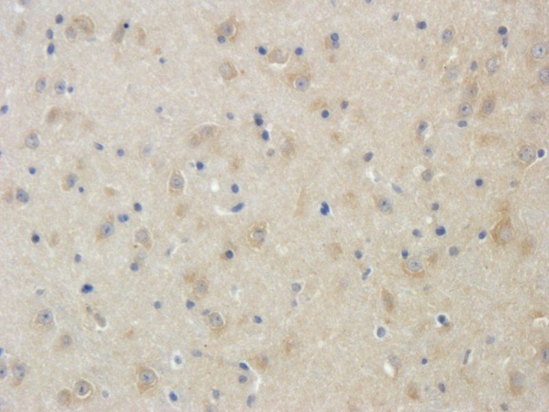 LRIG1 Rabbit Polyclonal Antibody