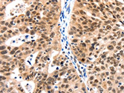 LRP5 Antibody