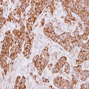 LRP(MVP) Rabbit Polyclonal Antibody