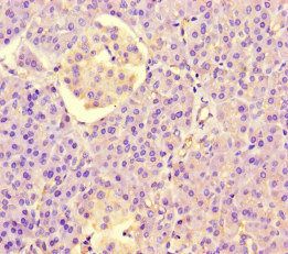 LRR1 Antibody