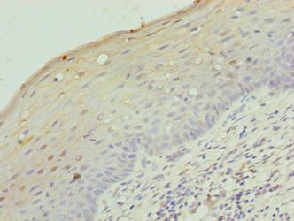 LRRC18 Antibody
